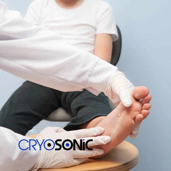 Are you looking for fast effective wart removal Contact us today Widnes